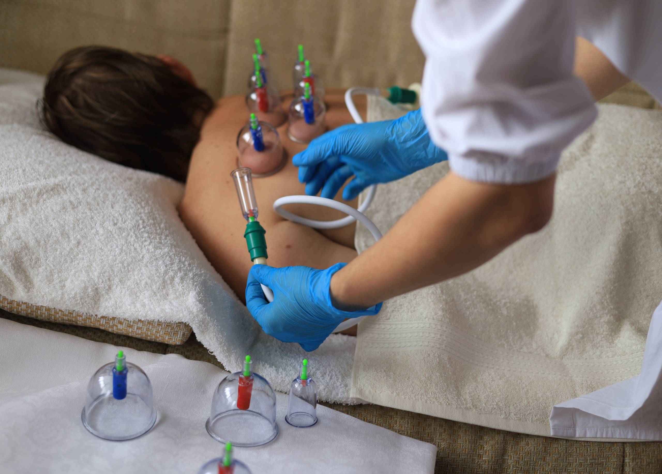 Vacuoterapia