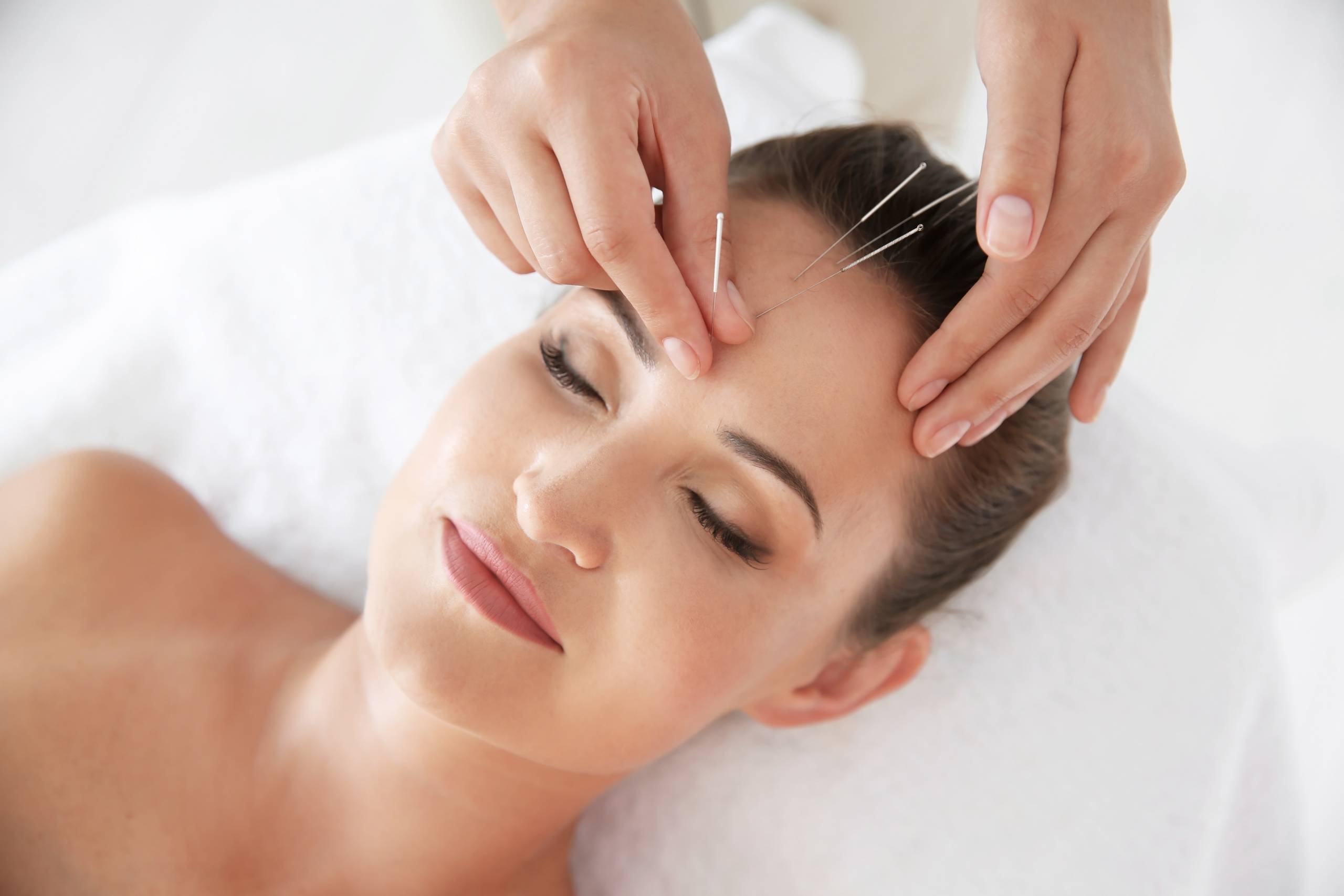 Acupuntura facial